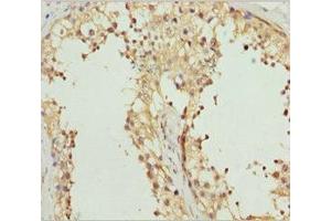 Immunohistochemistry of paraffin-embedded human? (Receptor Accessory Protein 1 抗体  (AA 101-201))