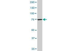 Western Blotting (WB) image for anti-Cleavage and Polyadenylation Specific Factor 3, 73kDa (CPSF3) (AA 585-684) antibody (ABIN565650)