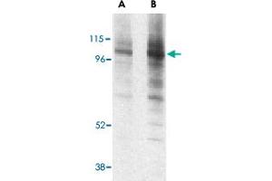 Western blot analysis of LAMP1 in EL4 cell lysate with LAMP1 polyclonal antibody  at (A) 1 and (B) 2 ug/mL . (LAMP1 抗体  (Internal Region))