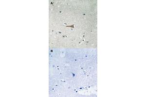 Immunohistochemical staining of human brain tissue by DDR1 (phospho Y513) polyclonal antibody  without blocking peptide (A) or preincubated with blocking peptide (B) under 1:50-1:100 dilution. (DDR1 抗体  (pTyr513))