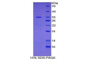 SDS-PAGE analysis of Mouse Pyridoxal Kinase Protein. (PDXK 蛋白)