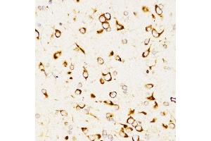 Immunohistochemistry of paraffin-embedded rat brain using L antibody (ABIN3023426, ABIN3023427, ABIN3023428 and ABIN6219891) at dilution of 1:200 (40x lens).