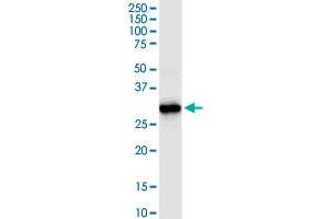 HADH MaxPab rabbit polyclonal antibody. (HADH 抗体  (AA 1-314))