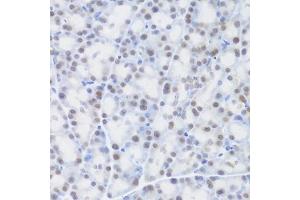 Immunohistochemistry of paraffin-embedded rat pancreas using MCM4 Antibody (ABIN5971548) at dilution of 1/100 (40x lens). (MCM4 抗体)