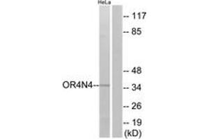 Western blot analysis of extracts from HeLa cells, using OR4N4 Antibody. (OR4N4 抗体  (AA 56-105))