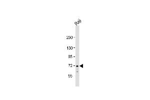 Anti-SYK Antibody  at 1:1000 dilution + Raji whole cell lysate Lysates/proteins at 20 μg per lane. (SYK 抗体  (C-Term))