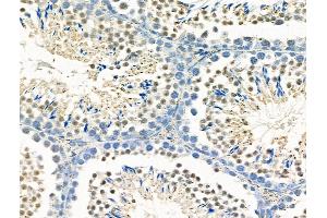 ABIN6259565 and ABIN6275780 at 1/100 staining Mouse testis tissue by IHC-P.