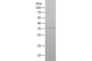 Spermatogenesis Associated 1 (SPATA1) (AA 120-228) protein (His-IF2DI Tag)
