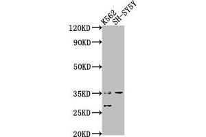 Western Blot Positive WB detected in: K562 whole cell lysate, SH-SY5Y whole cell lysate All lanes: THOC6 antibody at 1:2000 Secondary Goat polyclonal to rabbit IgG at 1/50000 dilution Predicted band size: 38, 35, 33 kDa Observed band size: 35 kDa (THOC6 抗体  (AA 56-315))