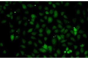 Immunofluorescence analysis of A-549 cells using C1S Polyclonal Antibody (C1S 抗体)