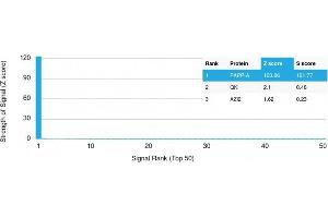 Analysis of Protein Array containing more than 19,000 full-length human proteins using PAPP-A Mouse Monoclonal Antibody (PAPPA/2715) Z- and S- Score: The Z-score represents the strength of a signal that a monoclonal antibody (MAb) (in combination with a fluorescently-tagged anti-IgG secondary antibody) produces when binding to a particular protein on the HuProtTM array. (PAPPA 抗体  (AA 351-523))