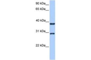 Western Blotting (WB) image for anti-Kelch Domain Containing 1 (KLHDC1) antibody (ABIN2463544) (KLHDC1 抗体)