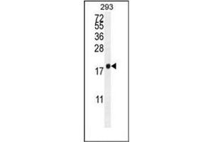 Western blot analysis of PCOTH Antibody (Center) in 293 cell line lysates (35ug/lane). (PCOTH 抗体  (Middle Region))