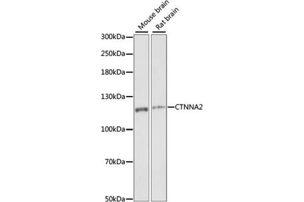 CTNNA2 抗体  (AA 150-300)