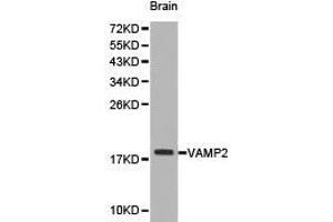 Western Blotting (WB) image for anti-Vesicle-Associated Membrane Protein 2 (Synaptobrevin 2) (VAMP2) antibody (ABIN1875306) (VAMP2 抗体)