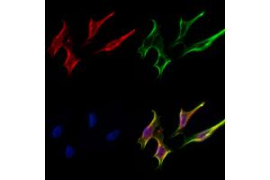 ABIN6264480 and ABIN6277000 staining Hela cells by IF/ICC. (PSMC3 抗体  (Internal Region))