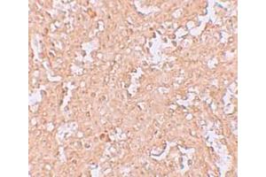 Immunohistochemistry (IHC) image for anti-Zinc Finger and BTB Domain Containing 8A (ZBTB8A) (C-Term) antibody (ABIN1030814) (ZBTB8A 抗体  (C-Term))