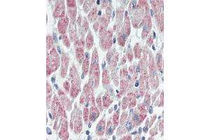Immunhistochemistry analysis in human heart tissue (Formalin-fixed, Paraffin-embedded) using USP19  (USP19 抗体  (Internal Region))