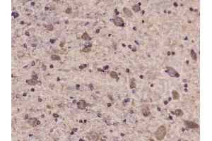 Paraformaldehyde-fixed, paraffin embedded rat brain Antigen retrieval by boiling in sodium citrate buffer (pH6. (TYK2 抗体  (pTyr1054, pTyr1055))