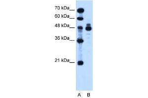 IHH antibody used at 1. (Indian Hedgehog 抗体)