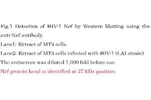 Western Blotting (WB) image for anti-HIV-1 Nef (full length) antibody (ABIN2452025) (HIV-1 Nef (full length) 抗体)