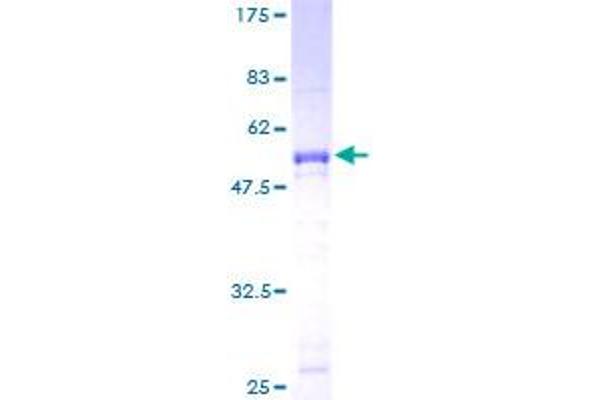 ATF2 Protein (AA 1-209) (GST tag)