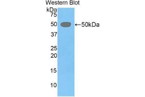 Western blot analysis of the recombinant protein. (LEFTY1 抗体  (AA 169-368))