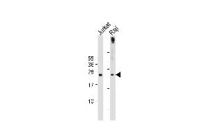 All lanes : Anti-hPHO1-M1 at 1:2000 dilution Lane 1: Jurkat whole cell lysate Lane 2: Raji whole cell lysate Lysates/proteins at 20 μg per lane. (Phosphate Transporter PHO1 (AA 1-30), (N-Term) 抗体)