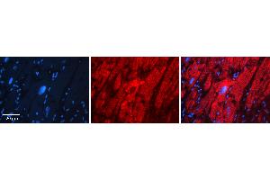 Immunohistochemistry (IHC) image for anti-Hyaluronidase-1 (HYAL1) (N-Term) antibody (ABIN2784343)