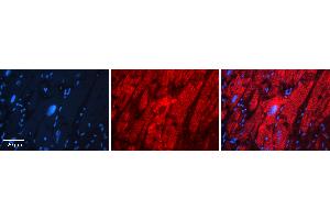 Rabbit Anti-HYAL1 Antibody   Formalin Fixed Paraffin Embedded Tissue: Human heart Tissue Observed Staining: Cytoplasmic Primary Antibody Concentration: 1:100 Other Working Concentrations: N/A Secondary Antibody: Donkey anti-Rabbit-Cy3 Secondary Antibody Concentration: 1:200 Magnification: 20X Exposure Time: 0. (HYAL1 抗体  (N-Term))