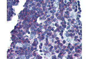 Anti-LAT antibody IHC of human thymus. (LAT 抗体  (Cytoplasmic Domain))
