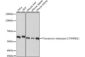 Western blot analysis of extracts of various cell lines, using Thioredoxin reductase 2 (Thioredoxin reductase 2 (TXNRD2 ) ) Rabbit mAb (ABIN7270807) at 1:1000 dilution. (TXNRD2 抗体)