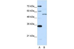ZNF707 antibody used at 0. (ZNF707 抗体  (N-Term))