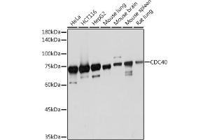 Western blot analysis of extracts of various cell lines, using CDC40 Rabbit mAb (ABIN7266255) at 1:1000 dilution. (CDC40 抗体)