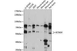 Western Blotting (WB) image for anti-Potassium Voltage-Gated Channel, Subfamily G, Member 4 (Kcng4) (AA 1-220) antibody (ABIN7269489)