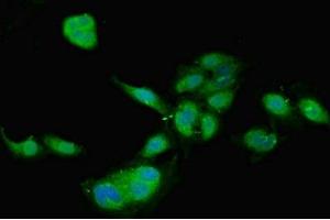 Immunofluorescent analysis of Hela cells using ABIN7159497 at dilution of 1:100 and Alexa Fluor 488-congugated AffiniPure Goat Anti-Rabbit IgG(H+L) (TIMP4 抗体  (AA 31-224))
