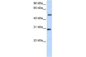 WB Suggested Anti-ZNF138 Antibody Titration:  0. (ZNF138 抗体  (N-Term))