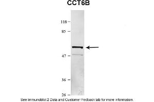 Sample Type: HEK 293 (10ug)Primary Dilution: 1:1000Secondary Antibody: conjugated goat anti-rabbitSecondary Dilution: 1:10,000Image Submitted By: Amy GrayBrigham Young University (Importin 5 抗体  (N-Term))