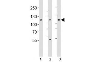 Western blot analysis of lysate from 1) HT-29, 2) HeLa, and 3) Jurkat cell line using JAK1 antibody (JAK1 抗体  (N-Term))