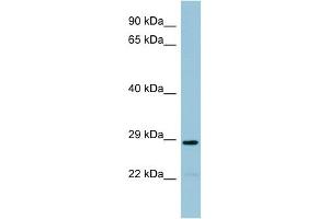 WB Suggested Anti-NAT8B Antibody Titration:  0. (NAT8B 抗体  (Middle Region))