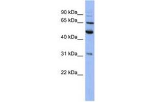 Image no. 1 for anti-Proteasome (Prosome, Macropain) 26S Subunit, Non-ATPase, 3 (PSMD3) (AA 107-156) antibody (ABIN6744086) (PSMD3 抗体  (AA 107-156))