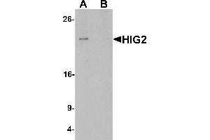 Western blot analysis of HIG2 in 3T3 cell lysate with HIG2 antibody at 1 µg/mL in (A) the absence and (B) the presence of blocking peptide.