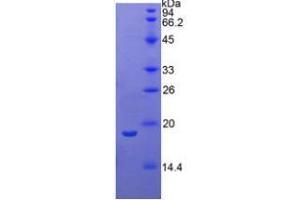 SDS-PAGE analysis of Human Phospholipase A1 Protein.
