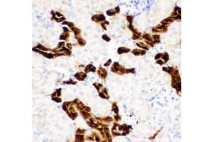 Anti-Calbindin Picoband antibody,  IHC(P): Mouse Kidney Tissue (CALB1 抗体  (AA 2-175))