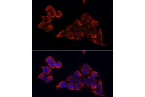 Immunofluorescence analysis of HeLa cells using MTOR antibody. (MTOR 抗体  (AA 2400-2500))