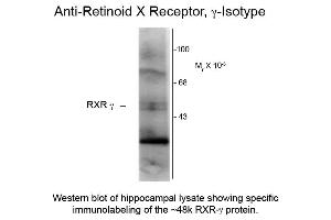 Western blot of Anti-Retinoid X Receptor gamma (Mouse) Antibody - 209-301-E28 Western Blot of Mouse anti-Retinoid X Receptor gamma antibody. (Retinoid X Receptor gamma 抗体)