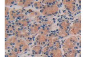 Detection of IL16 in Human Stomach Tissue using Polyclonal Antibody to Interleukin 16 (IL16) (IL16 抗体  (AA 1203-1332))