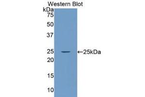Western blot analysis of the recombinant protein. (LAMa4 抗体  (AA 832-1039))