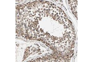 Immunohistochemical staining of human testis with ZNF37A polyclonal antibody  shows cytoplasmic positivity in cells of seminiferus ducts at 1:20-1:50 dilution. (ZNF37A 抗体)