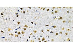 Immunohistochemistry of paraffin-embedded Rat brain using LGALS3 Polyclonal Antibody at dilution of 1:200 (40x lens). (Galectin 3 抗体)